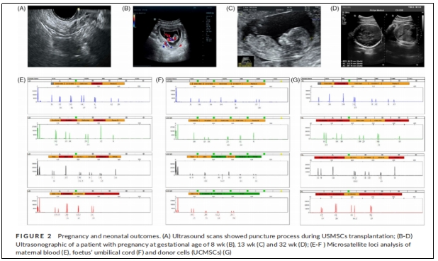 圖2:妊娠和新生兒結果。 圖2:妊娠和新生兒結果。
